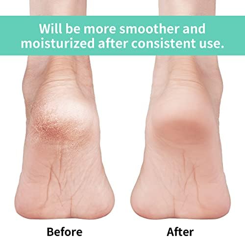 Vaincre Gel Moisturizing Heel Socks for Dry Cracked Feet Women, 4 Pairs Foot Care Spa Moisture Toeless Socks for Cracked Heel Repair Treatment Overnight (Regular)