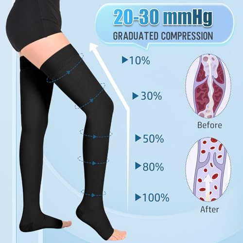 Athbavib 20-30mmHg Compression Stockings for Women and Men, Thigh High Closed Toe Medical Graduated Compression Socks, Best Support for Treatment Varicose Veins Swelling