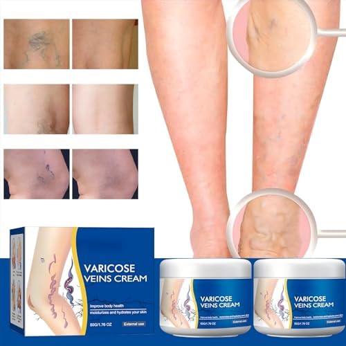 Varicose Veins Treatment Cream for Legs Natural Ingredients, Suitable for Most Skin Types