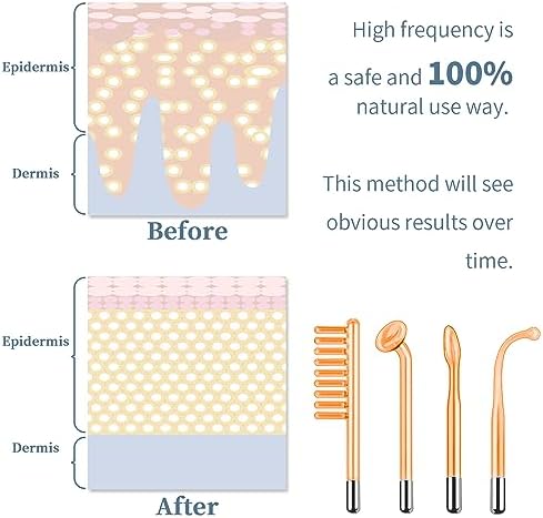 High Frequency Facial Machine - TUMAKOU Portable Handheld High Frequency Facial Skin Wand Machine with 4 Different Tubes
