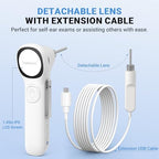 ScopeAround Digital Otoscope w/Built-in Screen, Manual-Focus Digital Otoscope with Light for Home Use, No App Needed, Easy Viewing for Everyday Ear Checks, Otoscope Camera, White