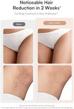 INIA Laser Hair Removal with Ice-Cooling Care for Women and Men, HAUTE Pro Painless at-Home IPL Hair Remover for Coarse Hair in Bikini All Body Areas, Latest Generation for Effective Results (Pink)