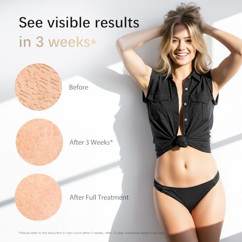 IPL Laser Hair Removal Device for Women & Men - Safe At-Home 45°F Ice-Cooling Contact for Painless & Long-Lasting Results, 86% Less Hair In 3 Weeks for Full Body & Face, White