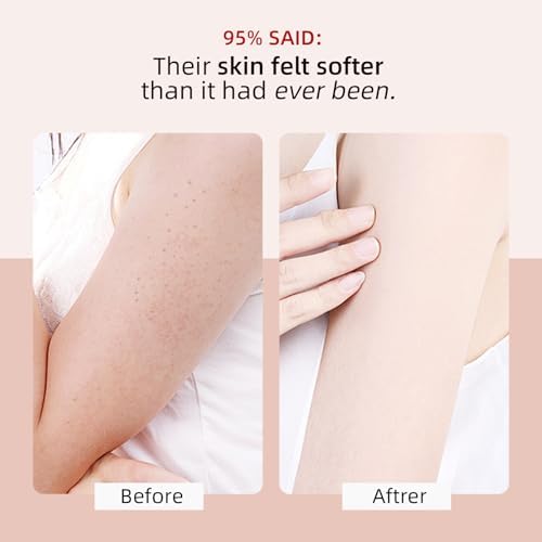KP Bump Eraser Body Scrub with 10% AHA BHA Ingrown Hair Keratosis Pilaris Razor Bump Treatment Exfoliating Body Scrub Exfoliant Face Scrubs for Strawberry Leg Pre-shaven Blackhead 4.23OZ