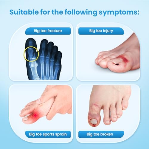 Big Toe Splint for Women & Men, Broken Big Toe Support Brace for Fracture Fixation,Sports Sprains,Injuries, Adjustable Big Toe Protector with 2 Stainless Steel Plates for Day & Night - Left（Beige）