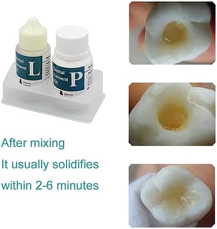 Zinc Oxide Eugenol Dental Cement Kit | Super Adhesive | Instant Tooth Repair, Cap, Crown & Bridge Filling | DIY, Self Curing, Sturdy & High Strength |Universal Shade| Emergency Dental Care |