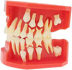 Teaching Model,Teeth Typodonts Dental Model - Teeth Eruption Development Model， Alternating Model of Constant Pressure of Deciduous Teeth，Silicone Material，Suitable for T
