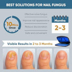 Nail Fungus Light Device, Home Use Toenail Light for Toenail Fingernails, Safe & Effective Solve Multiple Nail Problems BlacK-206