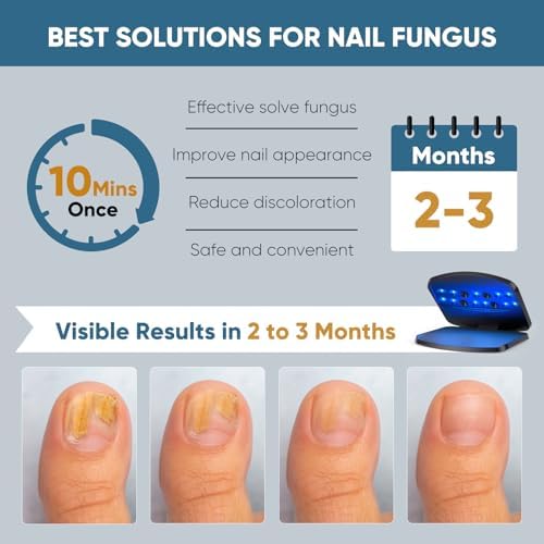 Nail Fungus Light Device, Home Use Toenail Light for Toenail Fingernails, Safe & Effective Solve Multiple Nail Problems BlacK-206