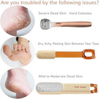Dual-Sided Foot File-Callus Shaver with 21 Blades-Stainless Steel Foot Callus Remover & Foot Scrubber for Removing Calluses, Aged Keratin, Hard Dead Skin-Heel Scraper Pedicure Tool Kit