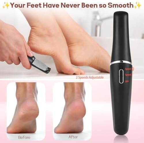 Electric Foot Callus Remover, Callus Remover for Feet Rechargeable Portable Pedicure Tool Kit, Smooth Pedicure Wand for Feet Care, Removes Dry Hard & Dead Skin Ideal Gift -Black