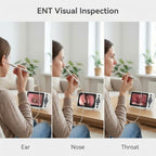 Digital Otoscope with 4.5" HD Screen, Ear Wax Removal Tool Kit with Camera, 3.9mm Ear Scope, No App or WiFi Needed, 32GB Card, Visual Ear Cleaner for Adults, Kids & Pets, Photo and Video