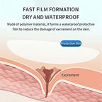 No Sting Ostomy Barrier Spray - Skin Barrier Film for Sensitive Skin - Skin Barrier for Protection Around Stomas and Wounds