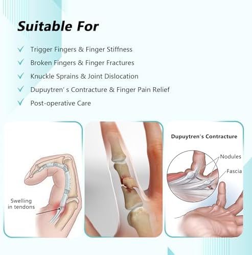 Trigger Finger Splint, Adjustable Two Finger Splint with Upgraded Wrist Strap, Full Hand and Wrist Brace Support, Metal Straightening Immobilizer for Sprains, Mallet Injury, Arthritis (S/M)