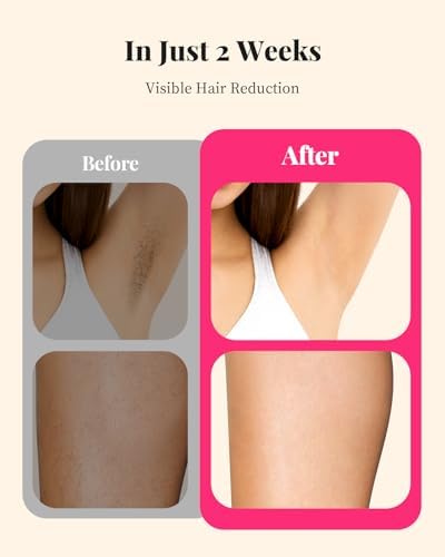LYSMOSKI Laser Hair Removal for Women and Men, At-Home IPL Hair Removal Device with 5.2 cm² Treatment Window, Nearly Painless, Visible Results in 2 Weeks, Full Body Treatment in 8 Minutes,Bright white