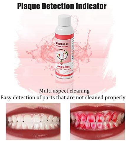 Plaque Disclosing Agent, 60ml Dental Plaque Indicator with Scale Cup, Oral Tartar Test Examination for Kids or Adults Teeth, Plaque Identifying, Care About Your Dental Hygiene