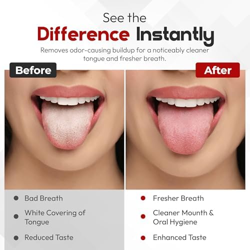 Tongue Scraper for Adults with Hygienic Mini Case (2 Pack) For Daily and travel use – Stainless Steel Metal Tongue scraper/Cleaner to Reduce Bad Breath and Improve Oral Hygiene