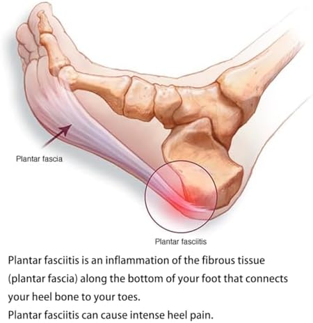 Shoe Insert for Flat Foot Pain，Arch Support Pad Orthotic for Plantar Fasciitis，Shoe Insole Foot Sleeve (Green, One Size Fit Most)