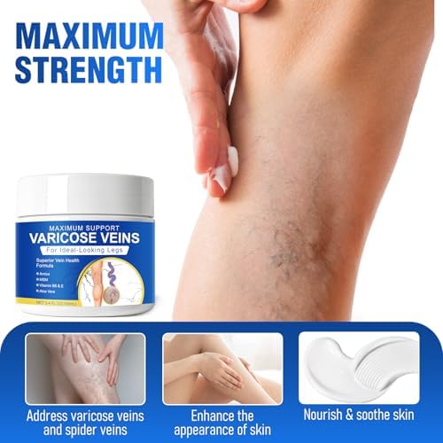 Varicose Veins Treatment for Legs, 3.4 Oz, Varicose Veins Cream for Spider Veins, Soothing Leg Cream Formula to Reduce Spider Veins, Improve Blood Circulation & Smooth Skin, Natural Formula