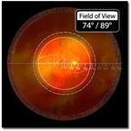 Volk Optical 90D Indirect Ophthalmic Slit Lamp Lens - Blue