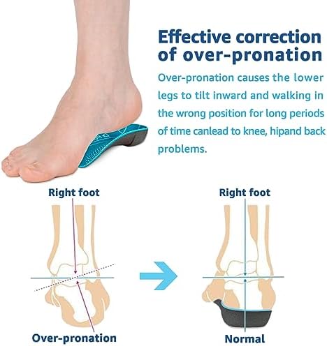 3/4 Orthotic Insoles, Shoe Inserts for Plantar Fasciitis Relief, High Arch Support Inserts for Flat Feet, Over-Pronation and Heel Pain (X-Small(Men's 3-4.5 / Women's 4-5.5))