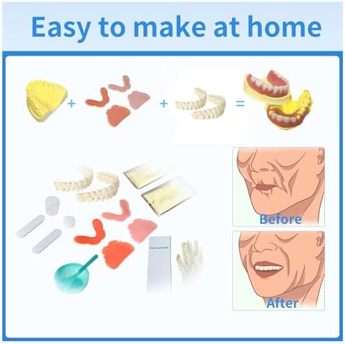 12-Piece DIY Denture Kit,2 sets (28 teeth per set) of false teeth in different sizes, for full or partial fake teeth,Includes all necessary materials for making top and bottom false teeth at home.