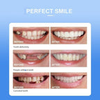 Unisex Adjustable Smile Supports: Natural Comfort Dentures for Men & Women, Snap-On Veneers Teeth Covers for a Confident, Beautiful Smile