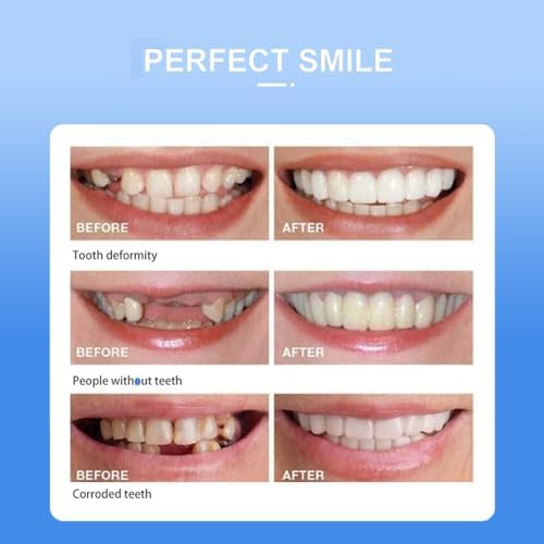 Unisex Adjustable Smile Supports: Natural Comfort Dentures for Men & Women, Snap-On Veneers Teeth Covers for a Confident, Beautiful Smile