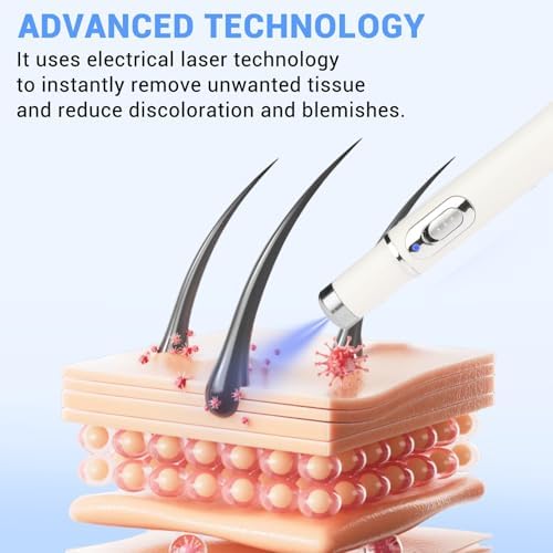 Maximum Strength WART Remover,Mole and Wart Removal Pen,Dark Spot Remover for Face and Body, Comfortable and Effevtive.