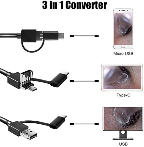 Ear Wax Removal - 3 in1 USB Earwax Removal Tool HD Ear Cleaner Endoscope with 6 LED Light, Earwax Remover Tool, Visual Ear Camera Ear Pick Cleaning Kit for Adults Kids Pets by Android Smart Phones
