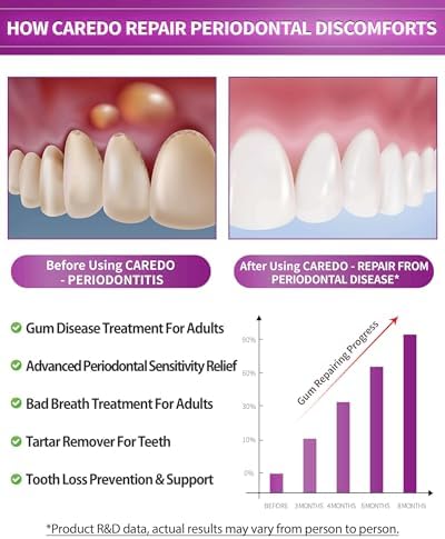 CAREDO Gum Toothpaste for Periodontitis, Gum Repair for Receding Gums, Gum Disease & Gingivitis Treatment, Periodontal Disease Treatment for Gum Health, Gum Disease Repair Bad Breath Toothpaste 3.52OZ