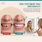 Snapon Smile Moldable Fake Teeth Covers (Upper & Lower) Veneer for Men & Women - Comfort Fit Natural Shade Clip on False Teeth