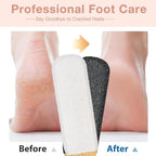 2 Pack Professional Pedicure Foot File & Pumice Stone - Callus Remover and Foot Scrubber Scraper & Exfoliator Tool for Dead Skin, Dry Rough Feet and Cracked Heels Elbows, Hands Home or Salon Use
