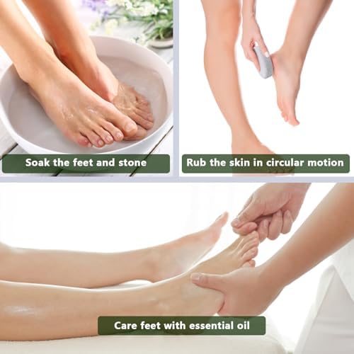 Natural Foot Pumice Stone for Feet, Borogo 2-Pack Lava Pedicure Tools Hard Skin Callus Remover for Feet and Hands - White