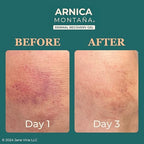 JANE VINE Arnica Gel For Face, Arnica Cream and Bruise Cream to Soothe with Aloe and Calendula for Face and Body, Menthol Free, Alcohol Free, 7oz Pump