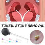 Tonsil Stone Remover, Manual Vacuum Tonsil Stone Removal Kit Tool, Dental Suction Mouth Cleaner Mouth Cleaning, Mouth Cleaner for Adults