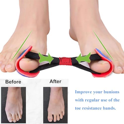 Toe Resistance Bands, Toe Bands for Bunions, Big Toe Strap Bunion Straightener Stretchy Belt, Bunion Corrector Strap, Toe Bunion Stretcher, Bunion Realignment Strap Corrector Foot Pain Relief