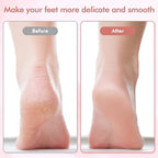 Electric Foot File and Callus Remover,Professional Pedicure Tools for Dry, Calluses, Dead, Cracked, Hard Skin,Equipped with 2 Grinding Heads and 1 Cleaning Brush