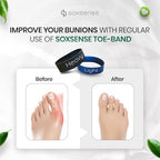 Soxsense Toe Stretcher Bands - Toe Spacers for Bunion Correction, Hallux Valgus Corrector, Foot Stretcher Resistance Band for Bunion Relief 2 PCS
