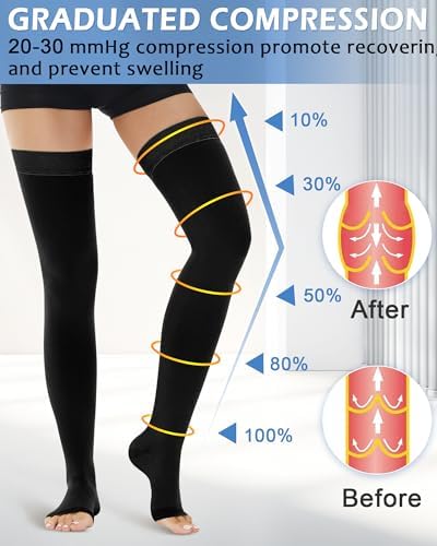 Ailaka Thigh High Medical Compression Stockings for Women Men, Open Toe Firm 20-30 mmHg Graduated Compression with Silicone Band for Varicose Veins, Edema, Post-Surgery