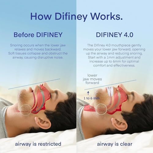 Advanced Anti Snoring Device 4.0: FDA-Cleared Snoring Solution – Adjustable Snore Stopper Mouth Guard for Men & Women – Anti Snoring Mouthpiece to Improve Sleep – Reusable Night Use