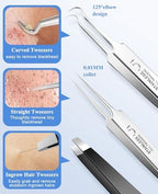 3PCS Blackhead Remover Tweezers, Pimple Popper Tool Kit with 2 Blackhead Extractor and 1 Ingrown Black Hair Tweezers for Blemish, Whitehead Popping,Facial Hair