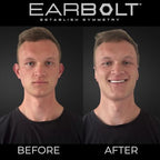 EARBOLT - Ear Pinning Adhesives | Cosmetic Ear Correctors, Pack of 20