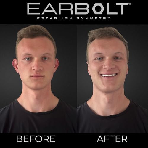EARBOLT - Ear Pinning Adhesives | Cosmetic Ear Correctors, Pack of 20