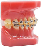 Dental Orthodontic Metal Brcket with Typodont Teeth Model