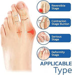 5 Pairs Orthopedic Toe Compression Sock Women's Toe Socks Projoint Antibunions Health Sock - Sock Align Toe Socks for Bunion - Anti Bunion Socks for Women and Men