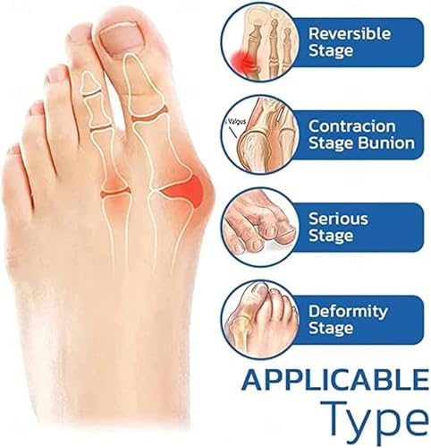 5 Pairs Orthopedic Toe Compression Sock Women's Toe Socks Projoint Antibunions Health Sock - Sock Align Toe Socks for Bunion - Anti Bunion Socks for Women and Men
