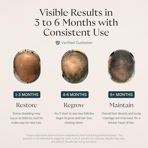 Happy Head Hair Supplement Capsules for Men & Women with Biotin, Collagen, Keratin, Ashwagandha, Vitamins D, Vitamin A, & Saw Palmetto, Daily Hair Care Support Formula, 1 Month Supply, 60 Capsules
