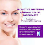 2 Pcs SP-6 Probiotic Whitening Toothpaste, Fresh Breath Deep Cleaning Care Gum Health.