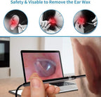3in1 USB Otoscope-Ear Scope Camera, Mini New Upgraded 5.5mm Diameter Visual Ear Camera HD Ear Endoscope with Earwax Cleaning Tool and 6 Adjustable LED Lights for OTG Android and Windows & Mac.